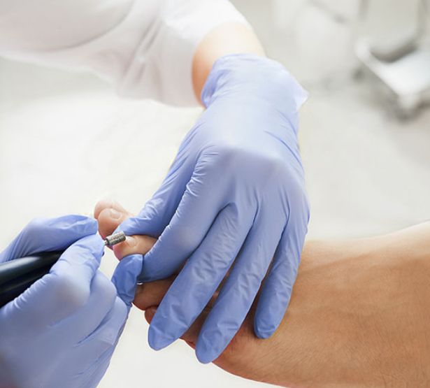 mise en cause pedicure macsf